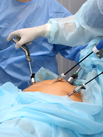 Gynae & Laparoscopy Services