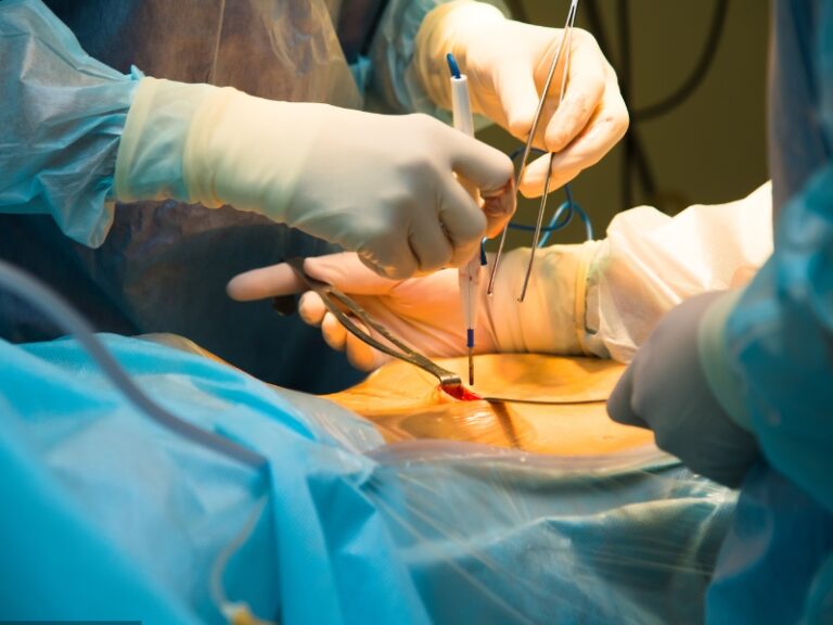 Gynae and Laparoscopy Surgery