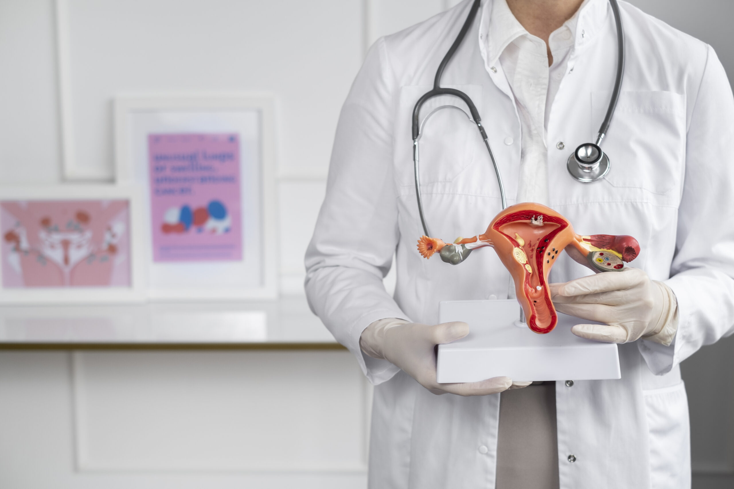 Polycystic Ovary Syndrome (PCOS)